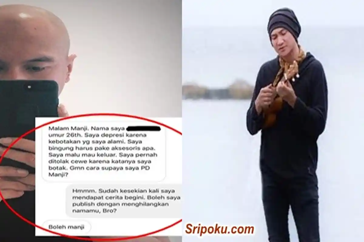 Curhat Soal 'Kebotakan', Dari Depresi Sampai Malu Keluar Rumah, Begini 3 Tips Super dari Anji Manji