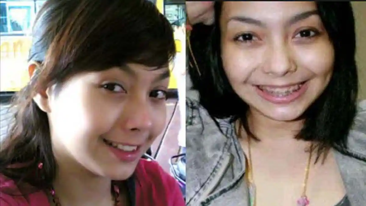 Artis FTV Cecilia Vickend Meninggal Karena Kanker Lidah, Waspada Makanan Panas Bisa Jadi Pemicu