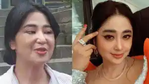Wajah-Dewi-Perssik-Bengkak-Hingga-Penampilannya-Berubah-Sang-Pedangdut-Ungkap-Penyebabnya.jpg