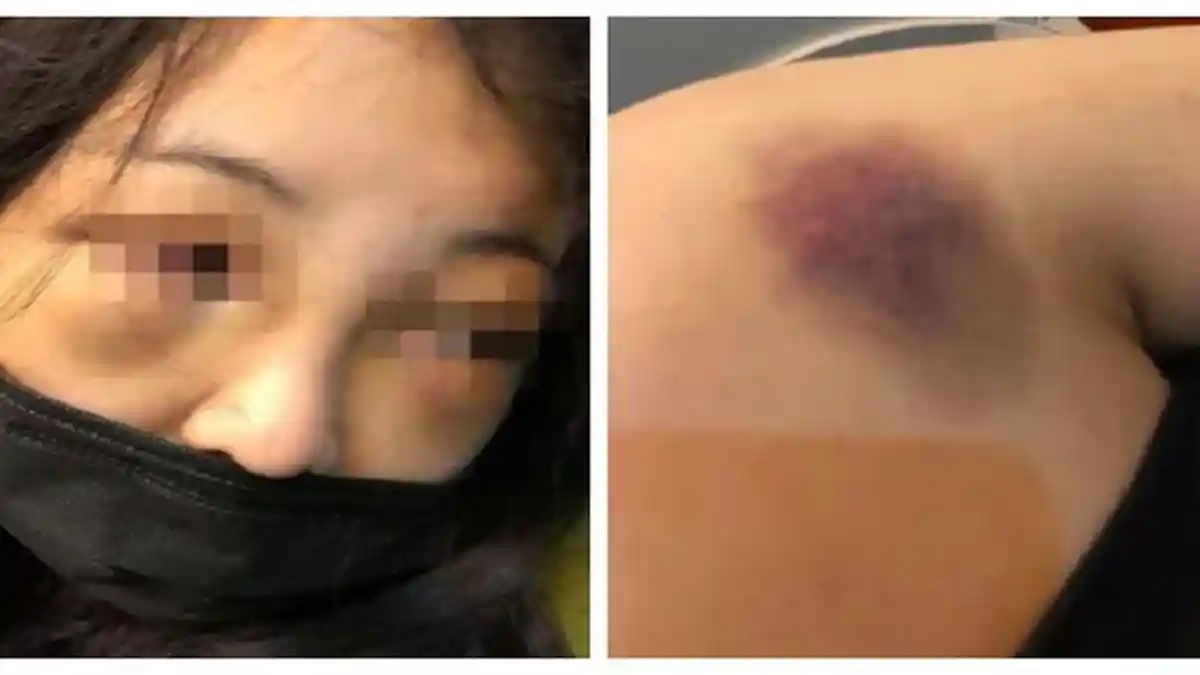 Gadis Ini Menjadi Korban Penganiayaan Gara-Gara Sering Mendengkur