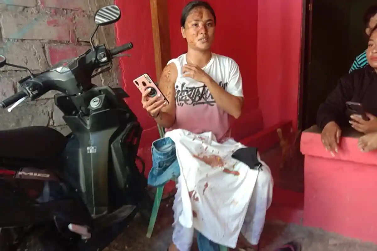 Natalia Manek Diduga Jadi Korban Operasi Pendisiplinan Protokol Kesehatan di Sumba Timur