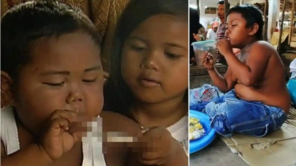 Bocah Ini Dulu Bisa Merokok 40 Batang Perhari? Kondisinya Sekarang Malah Mencengangkan
