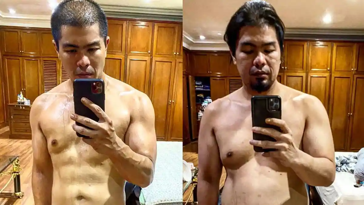 Bams Eks Samsons Mengaku Idap Kanker Langka karena Kebanyakan Olahraga