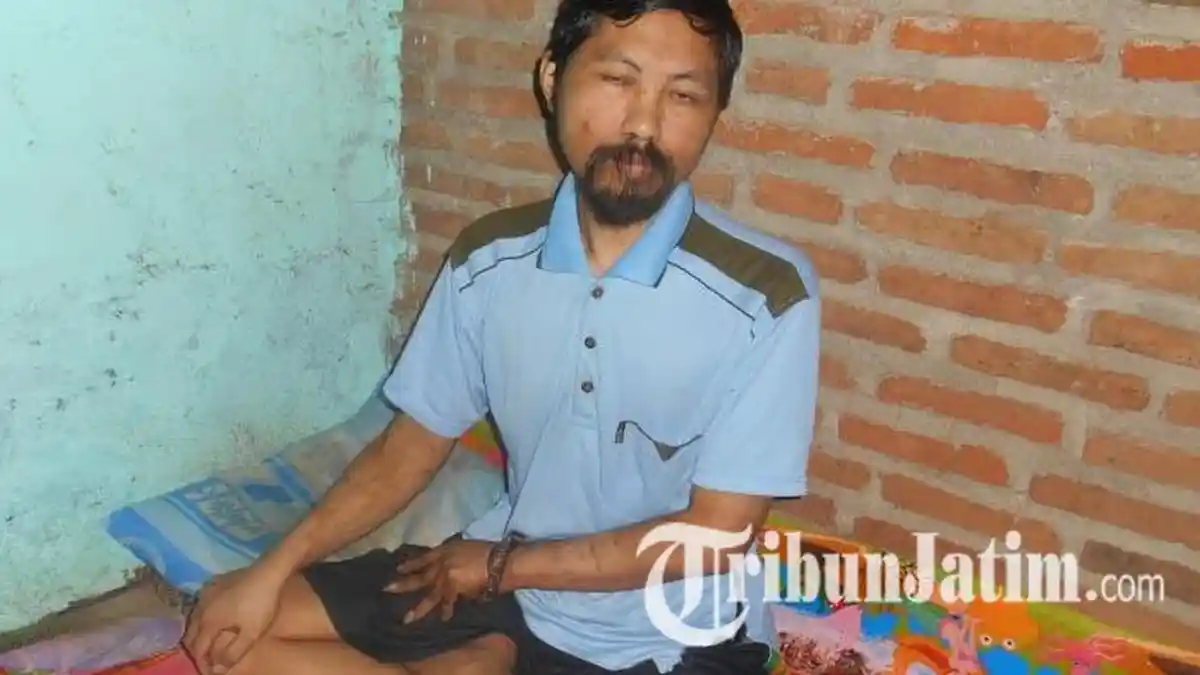 Sudah Tiga Tahun Pemuda di Kediri ini Tangannya Dirantai dan Diisolasi