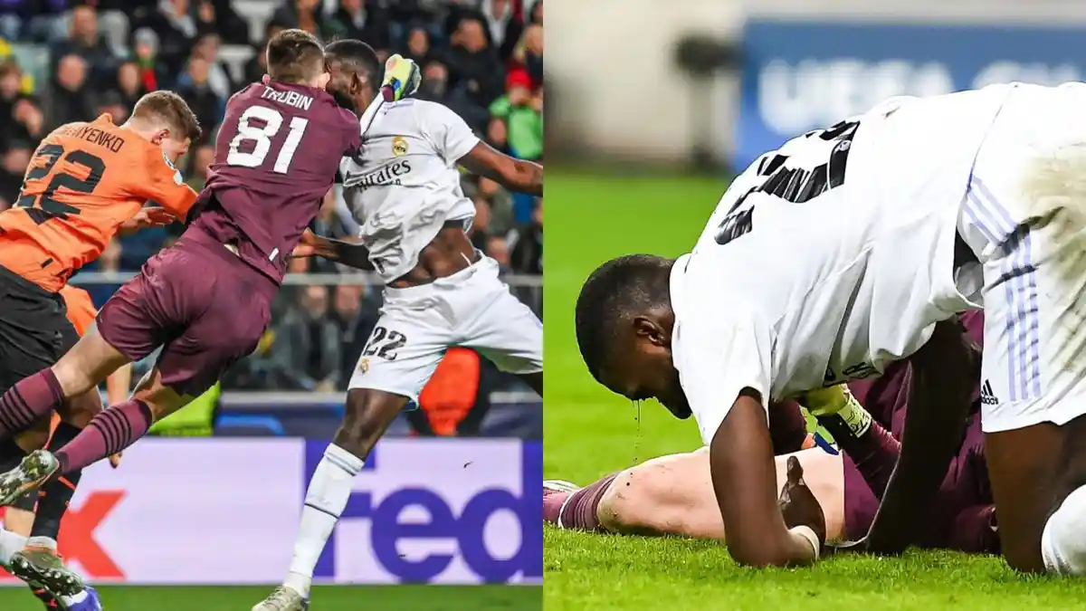 Kondisi Wajah Berdarah, Bek Real Madrid Ini Cuma Minta Ganti Baju dan Ingin Terus Bermain