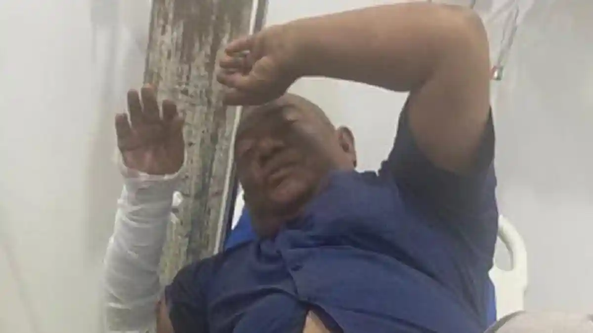Pikap Terbakar, Sopir Masih Dirawat di Rumah Sakit