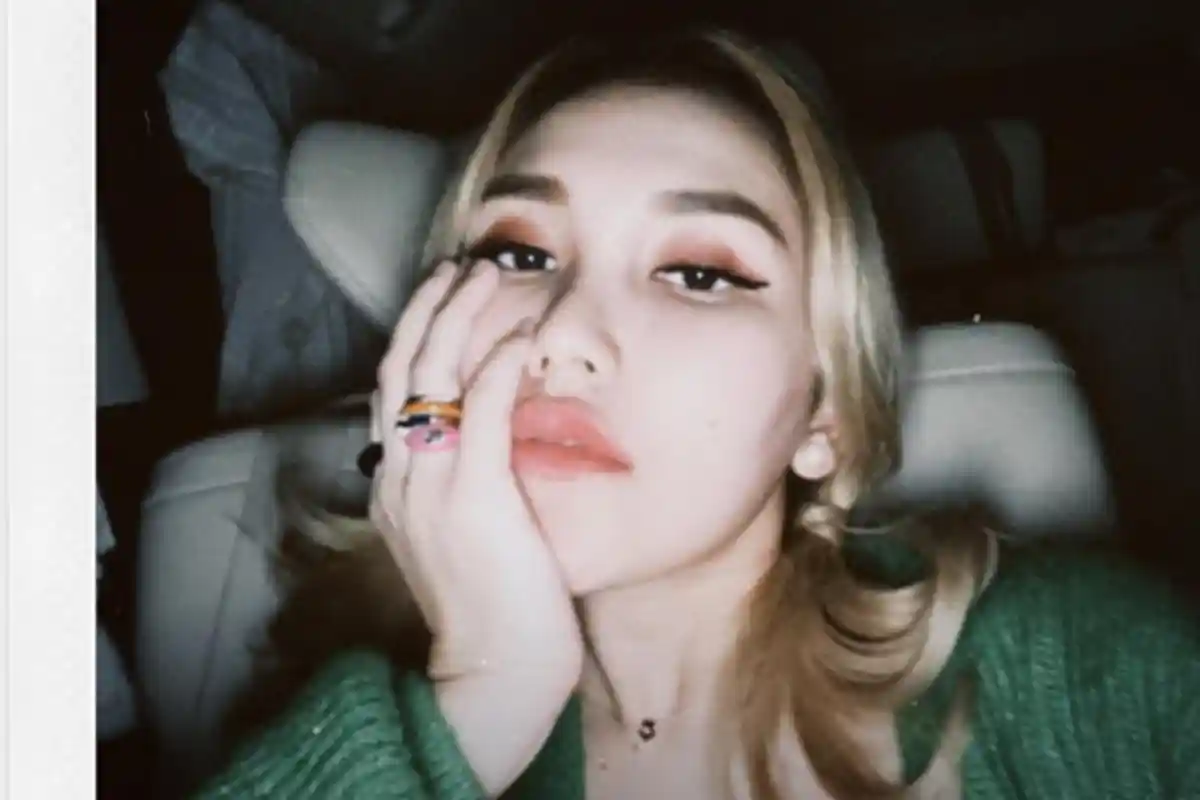 Kondisi Ayu Ting Ting, Bekas Infus di Tangan dan Wajah Pucat, Reaksi Ivan Gunawan dan Vega Darwanti