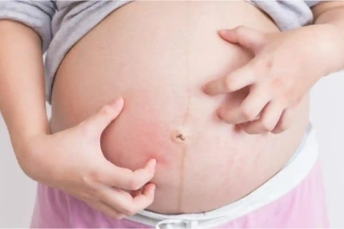 Gatal Gatal Saat Hamil Berefek Pada Janin