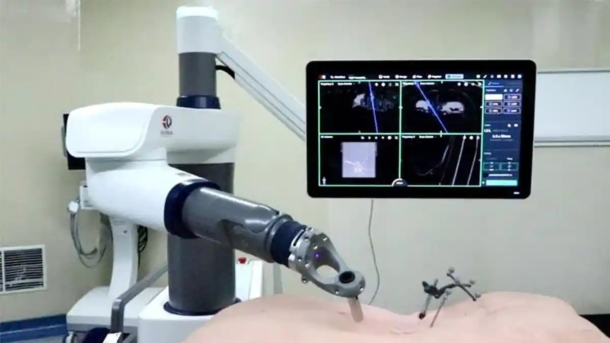 Tak Perlu ke Luar Negeri, Teknologi Robotik Da Vinci XI Bantu Operasi Kanker Prostat Lebih Aman