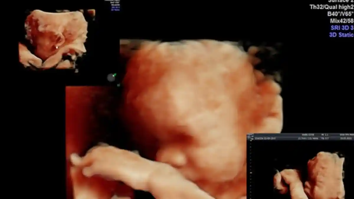 Ragam Keuntungan Lakukan USG 4D untuk Wanita Hamil, Ini Perbedaannya dengan 3D