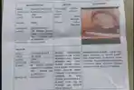 Tiga-Minggu-Tanpa-Kabar-Gadis-Asal-Kusamba-Klungkung-Bali-Ini-Dilaporkan-Hilang.jpg
