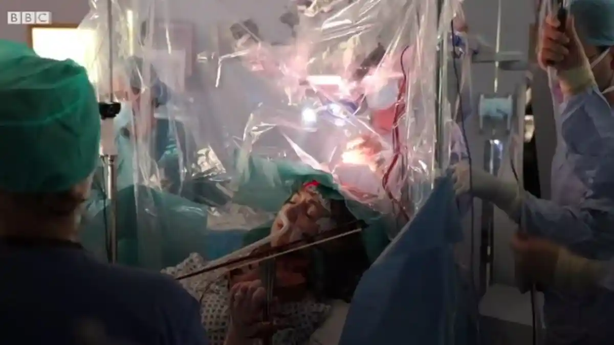 Viral Wanita di Inggris Bermain Biola Saat Jalani Operasi Pengangkatan Tumor Otak
