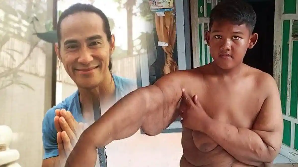 Ade Rai Ungkap Perubahan Perilaku Arya Permana yang Berat Badannya Susut 109 Kg