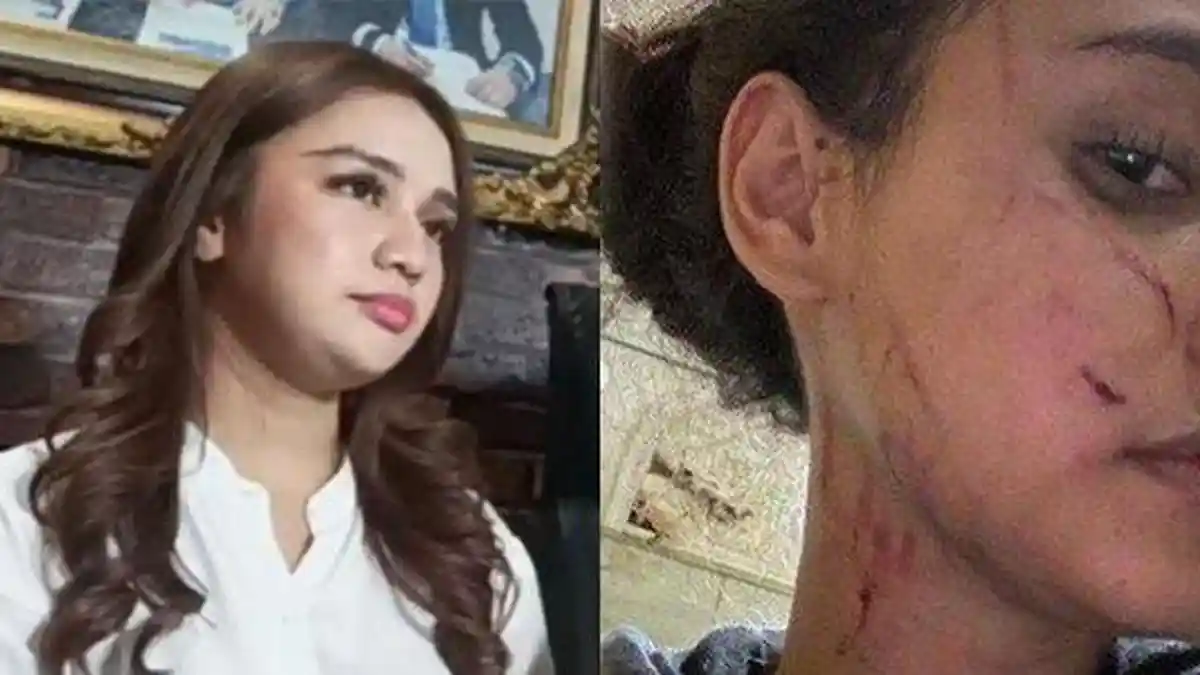 Regi Nazlah Bantah Tuduhan, Sebut Afifah Riyad yang Pukul Duluan, Ungkap Kronologi dan Bawa Bukti