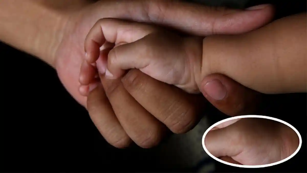 Mengejutkan! Tangan Bayi Warga Yogya Ini Muncul Tanda Lahir Menyerupai Lafal Allah