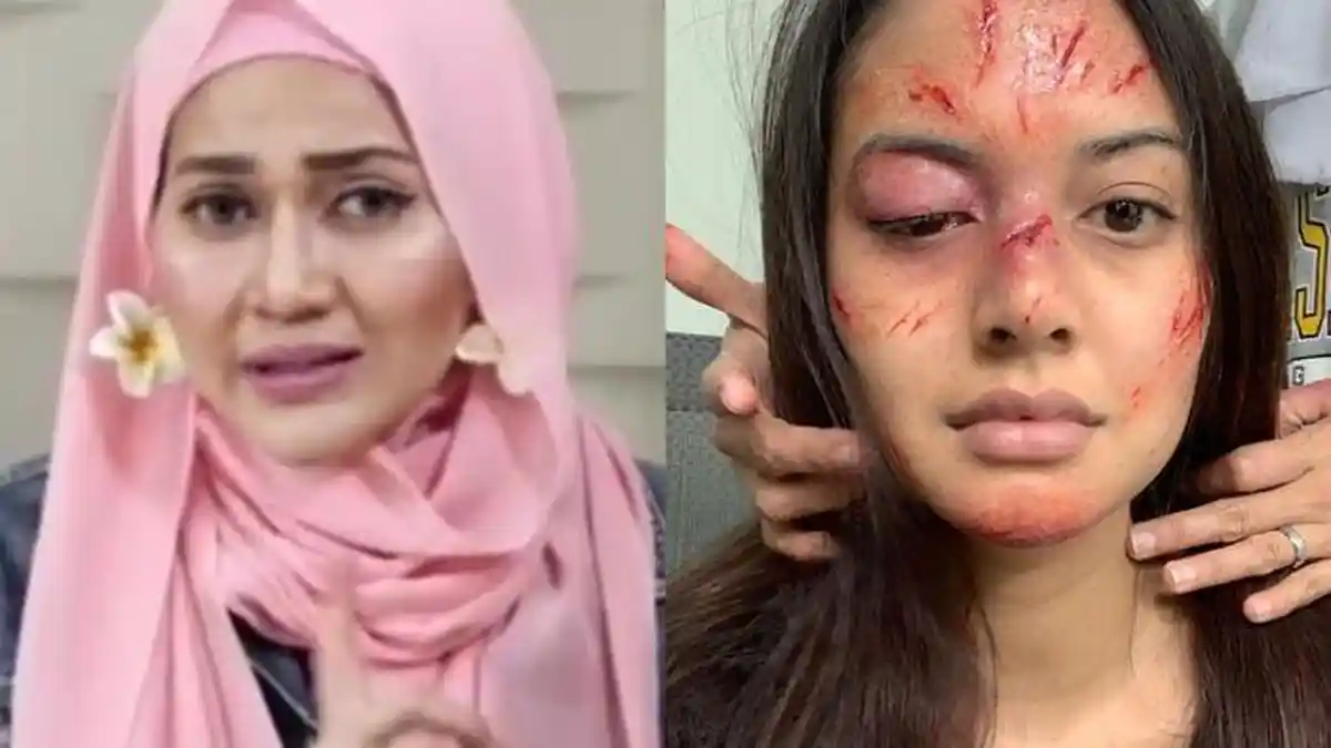 Gara-gara Make Up Wajah Babak Belur, Aurelie Moeremans 'Disentil' Poppy Amalia: Belajar Empati Lagi