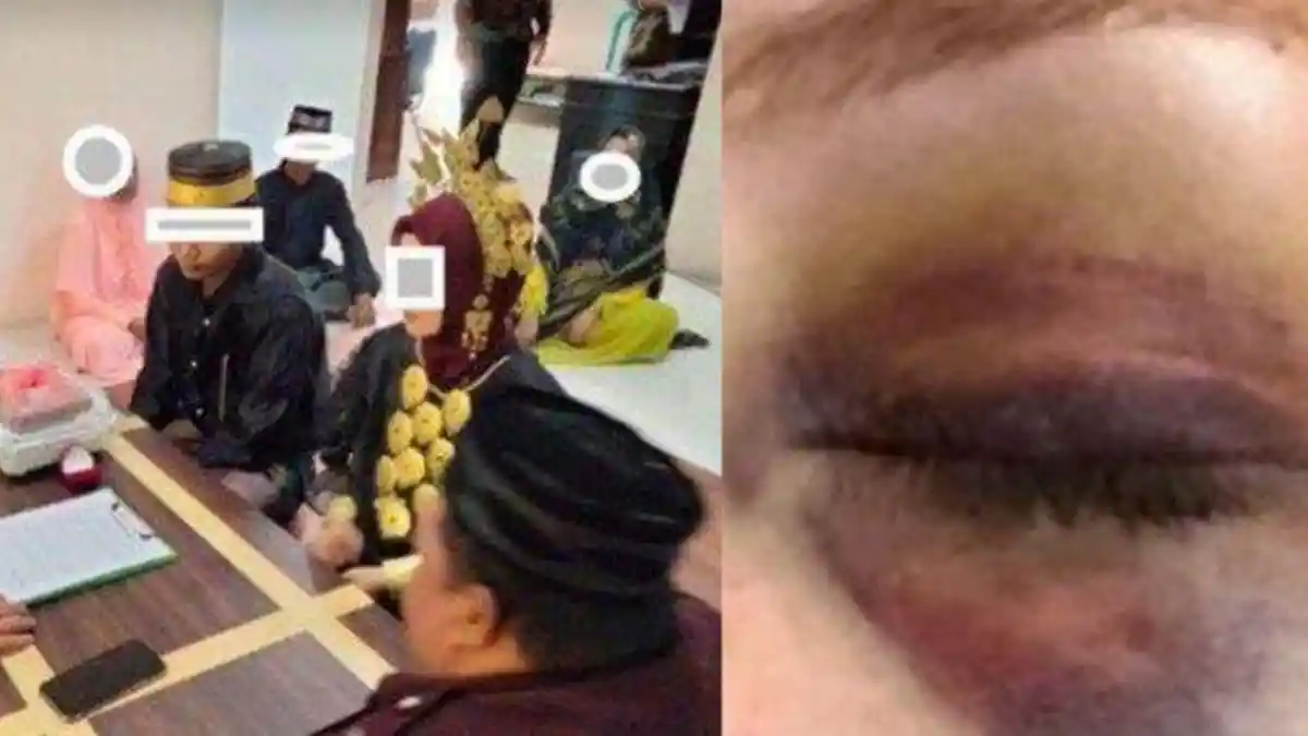 Curhat Kakak Kandungnya Dinikahi Eks Suami, Wanita Pilu Malah Dikeroyok Orangtua: Dibilang Kesurupan