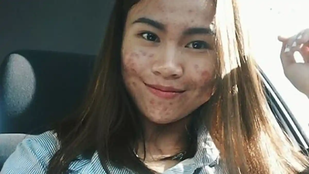 The Power Of Make Up - Wanita Berjerawat Ini Bikin Pangling Setelah diMakeup