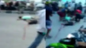 Sebelum-Meninggal-Korban-Kecelakaan-Motor-Vs-Truk-Kontainer-di-Kendari-Sempat-Ditangani-Rumah-Sakit.jpg