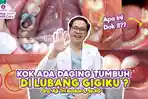 gigi-berlubang-cara-mengatasi.jpg