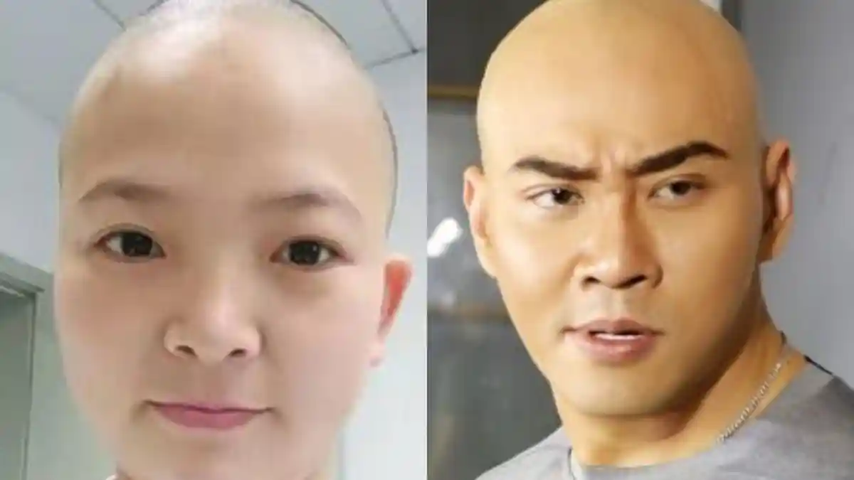 Perawat Ini Cukur Habis Rambutnya hingga Gundul Sepeti Deddy Corbuzier, Ternyata Ini Alasannya
