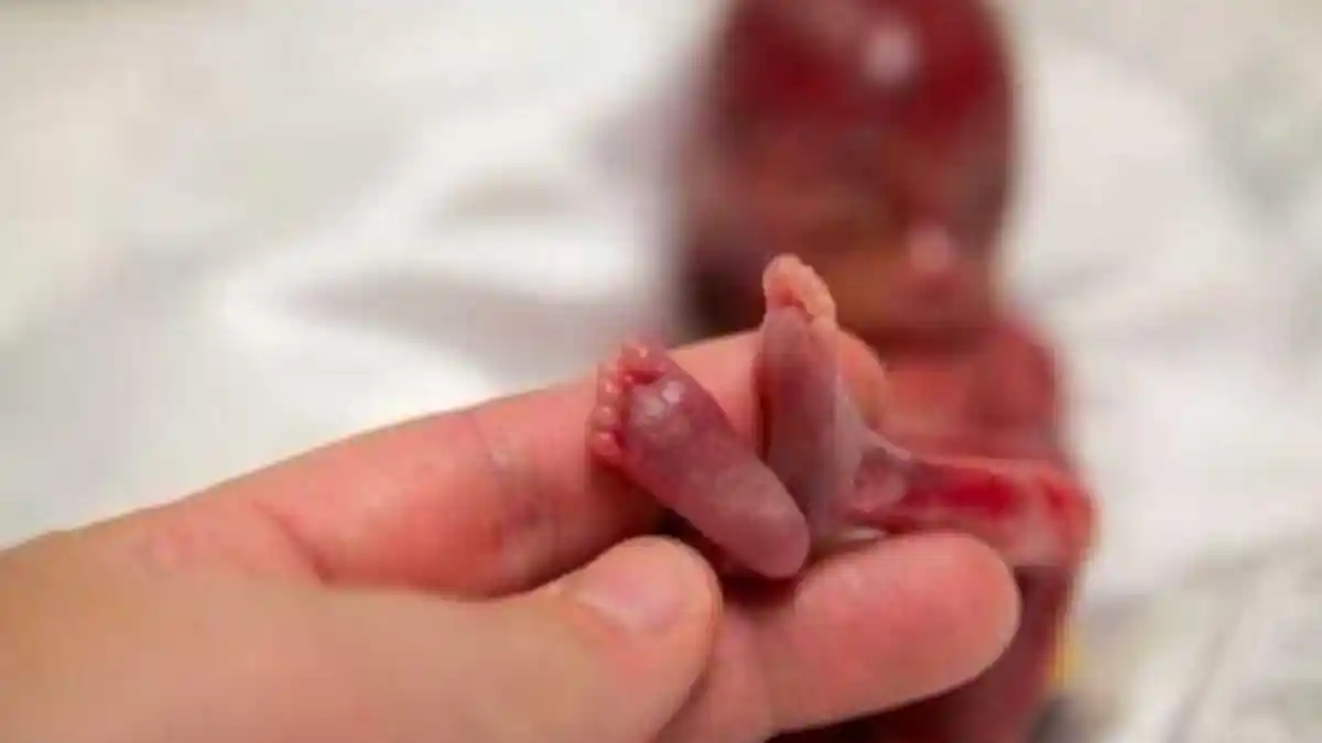 Mengapa Tren Kasus Angka Kematian Bayi di Blora Meningkat Tahun? Dinkes Ungkap Hal Ini