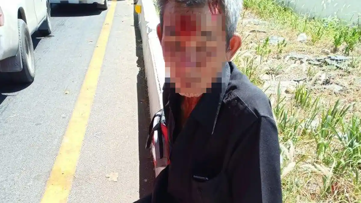 Seorang Pria Pukul Supir Taksi Lansia Pakai Helm dan Besi hingga Berdarah dan Masuk Rumah Sakit