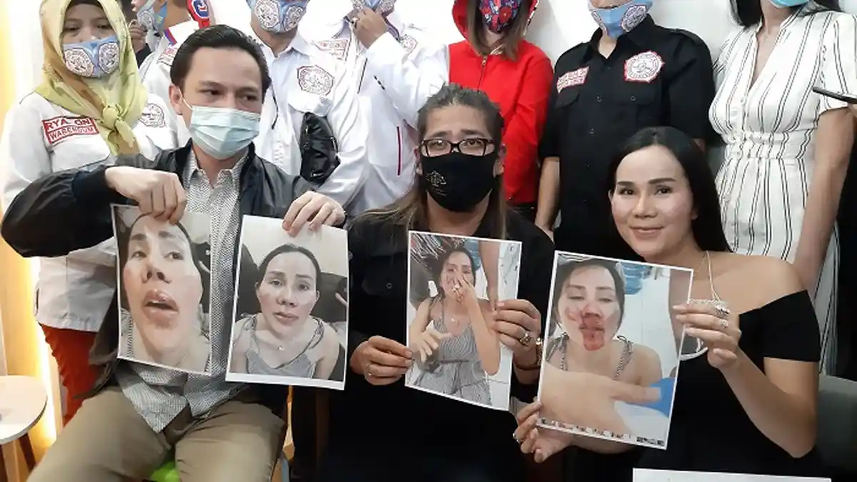 Dianiaya Sampai Hidung Bengkok, Mantan Manajer Lucinta Luna Trauma
