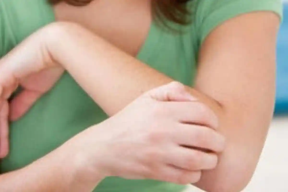 Ternyata Begini Tanda-tanda Tubuh Kekurangan Lemak, Diantaranya Luka Sulit Sembuh