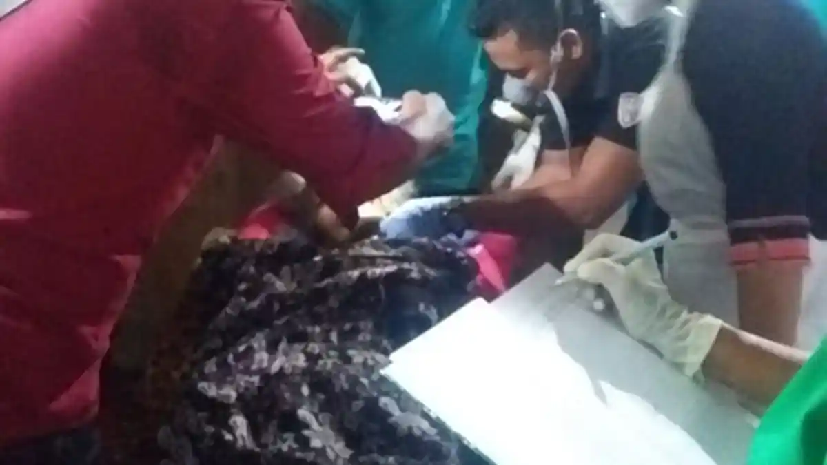 3 Bulan Sakit dan Tidak Sembuh, Wanita asal Waigete Ini Akhiri Hidupnya, Ini Kisahnya