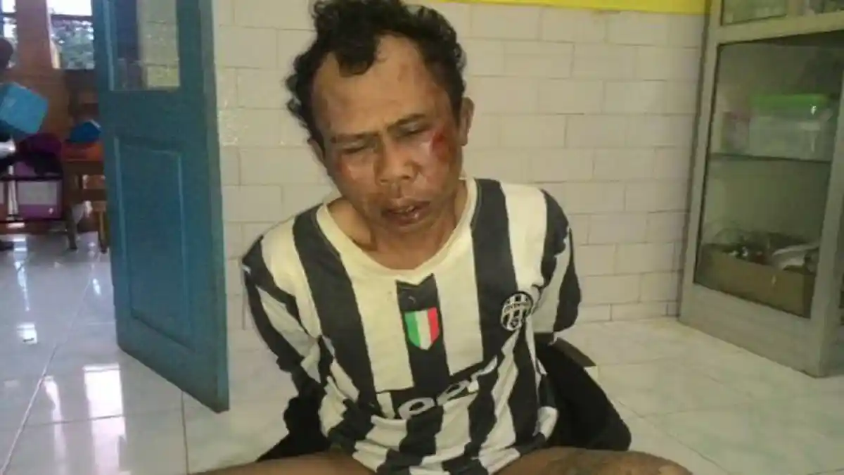 Zainal Hadang dan Duel dengan Pencuri Mobilnya yang Bawa Sajam