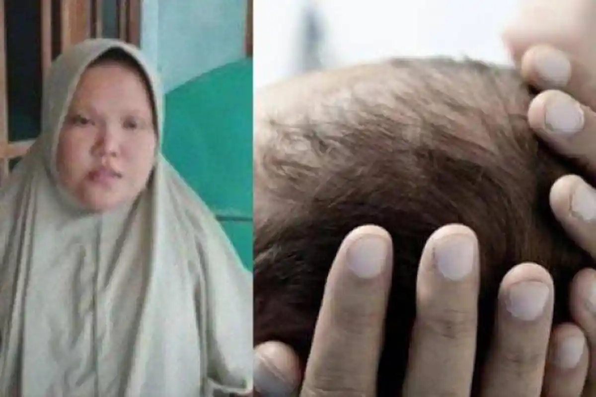 4 Fakta Kepala Bayi Tertinggal di Rahim, Kronologi, Penjelasan Dokter Forensik hingga Lapor Polisi