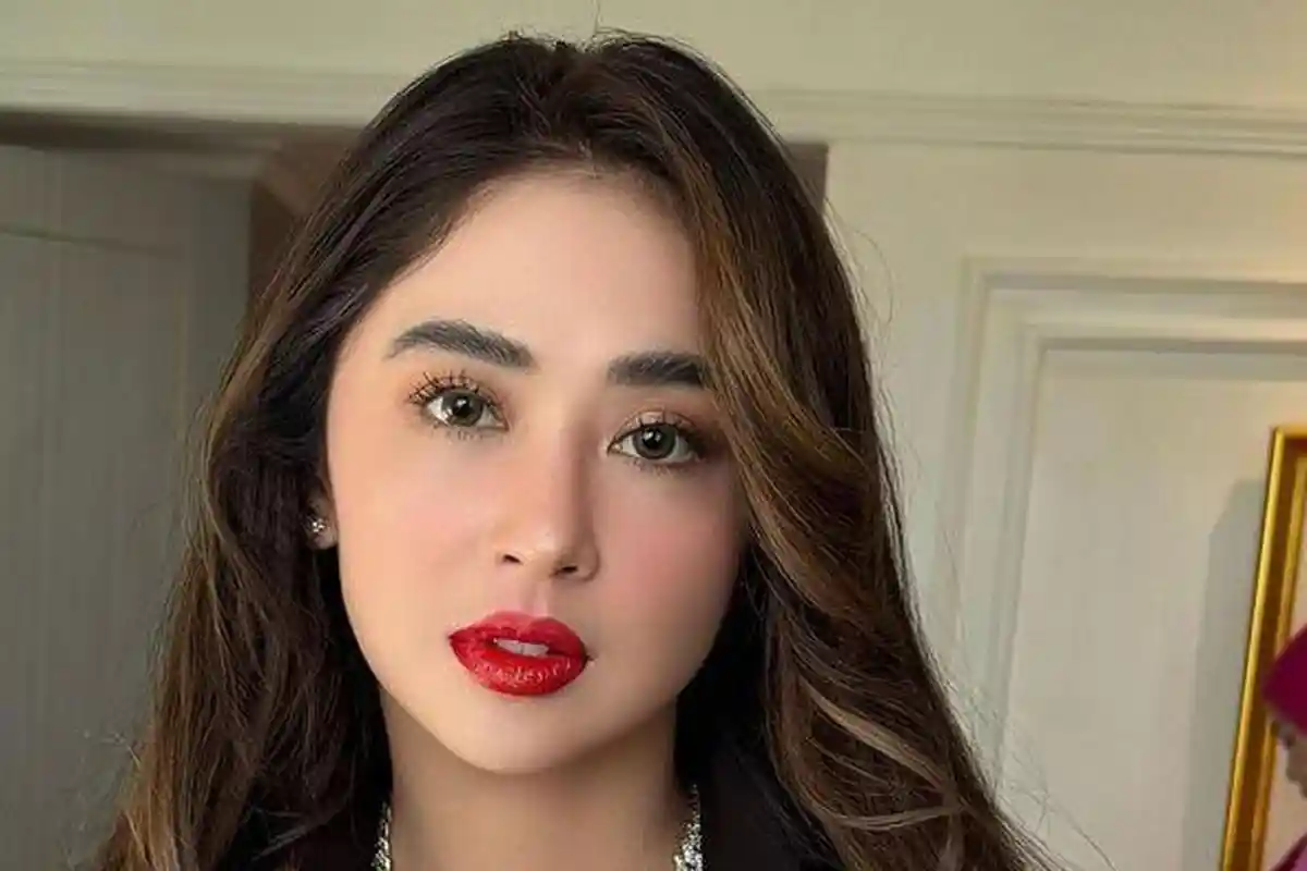 Alasan Dewi Perssik Tegas Tolak Endorse Permak Hidung di Korea Meski Dibayar Rp1 Miliar: Amit-amit
