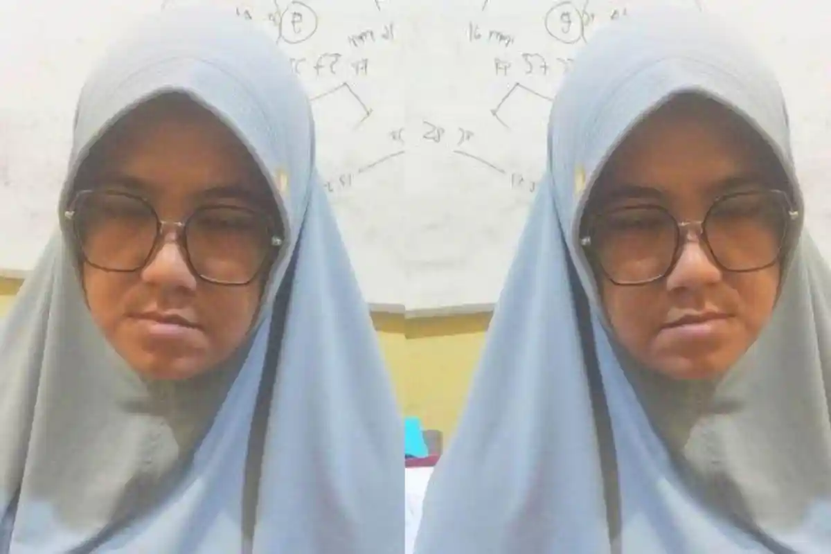 Tampang N, Ibu di Jambi Tega Setrika Anak Tiri Gegara Tak Dijatah Rp 8 Juta Perbulan oleh Suami