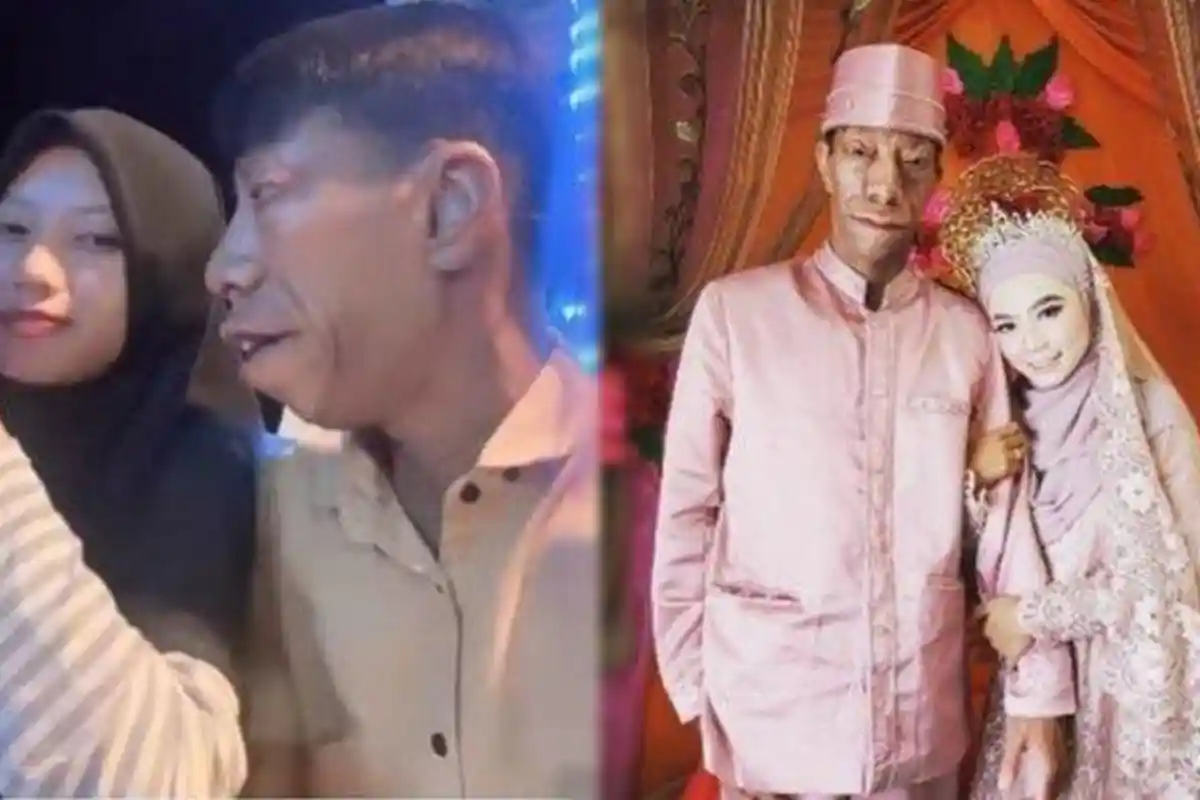 Sosok Surya Manurung, TikToker yang Idap Kelainan Genetik, Kini Nikahi Gadis Cantik Pujaan Hatinya