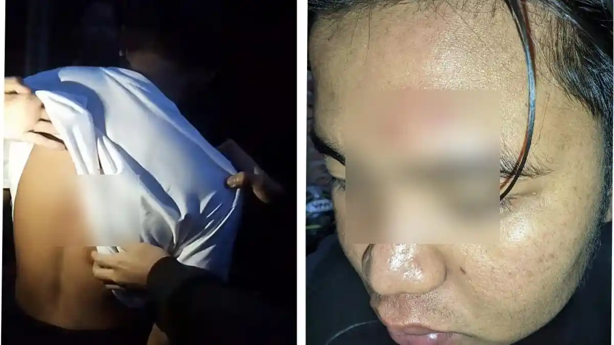 Pengeroyokan di Danau Dendam Tak Sudah Bengkulu, Dua Pemuda Terluka Parah