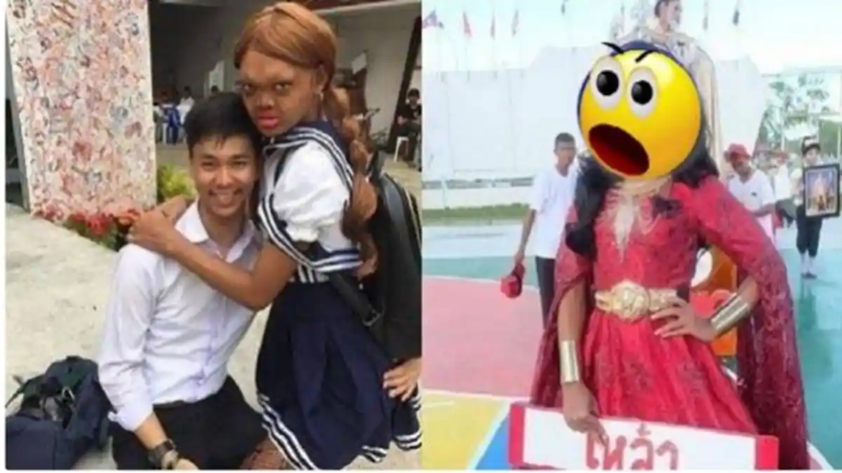 Miliki Paras Super Pesek, Siapa Sangka Gadis Ini Berhasil Patahkan Standar Kecantikan Dunia, Wow!