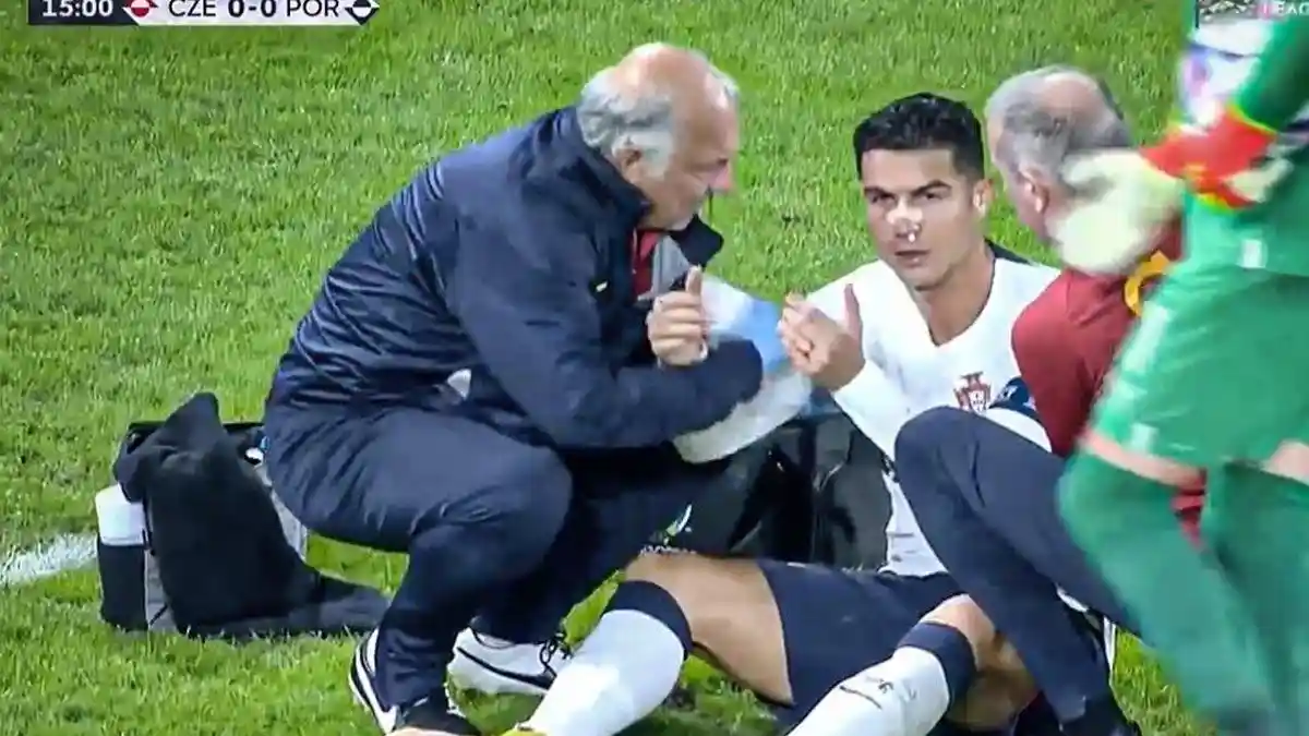 Cristiano Ronaldo Vs Rep Ceko, Hidung Berdarah-darah, Jadi Pelayan Bawa Portugal Menang