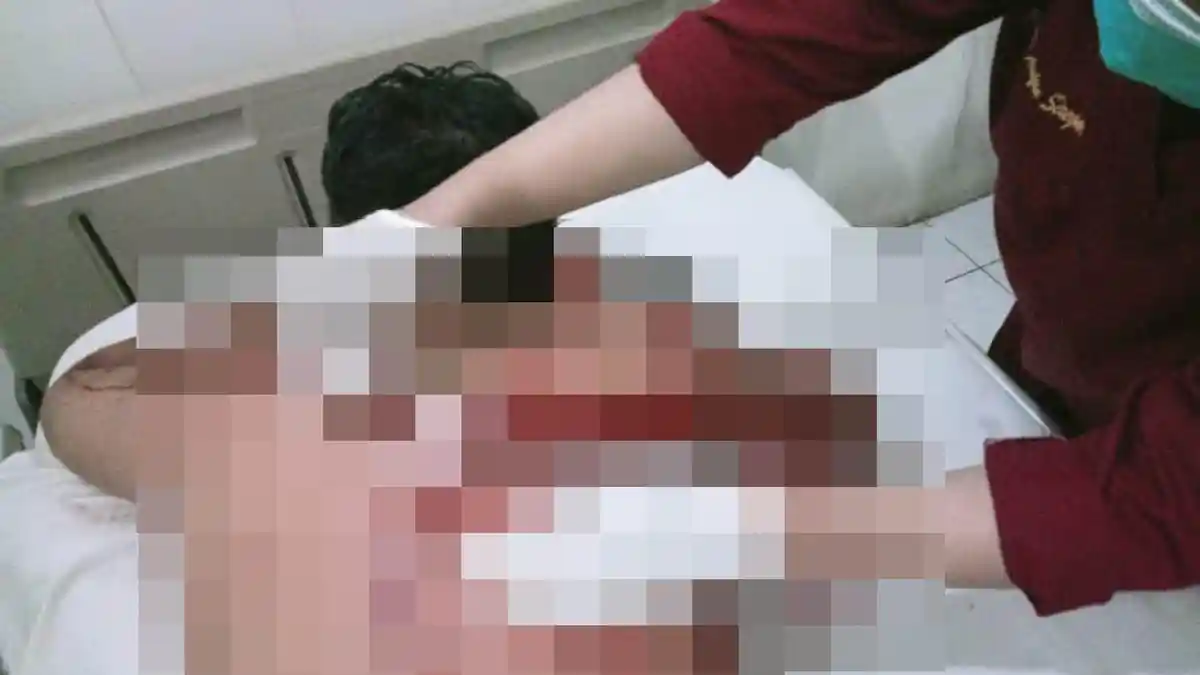 2 Ormas di Binjai Terlibat Bentrok, Satu Orang Terluka Kena Bacok, Diduga karena Penurunan Spanduk