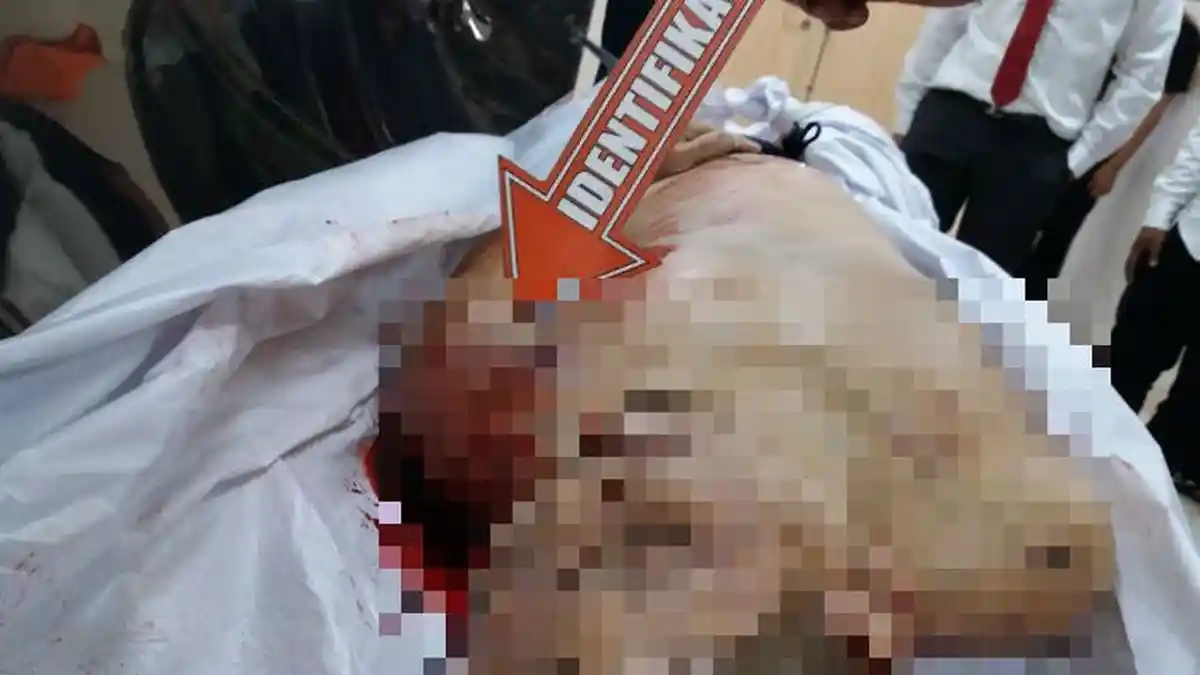 Diduga Depresi Penyakit Tak Kunjung Sembuh, Pasien Ini Lompat dari Lantai 6 RS Sumber Waras
