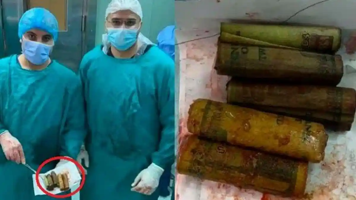 Mengeluh Sakit Perut Parah, Dokter Justru Kaget Temukan Uang Rp 5,6 Juta Dalam Perut Pasien