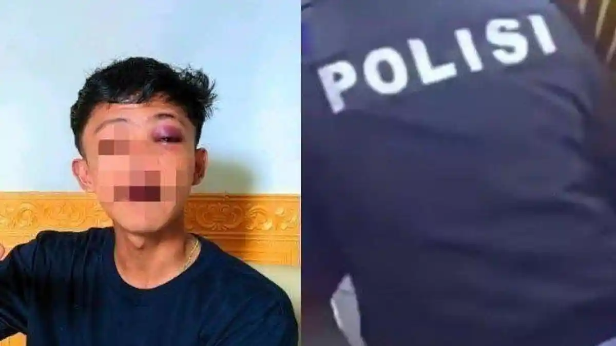 Awal Mula Abdul Aziz Pria Gorontalo Dipukul Polisi, Usai Dihajar Diberi Rp 50 Ribu Uang Tutup Mulut