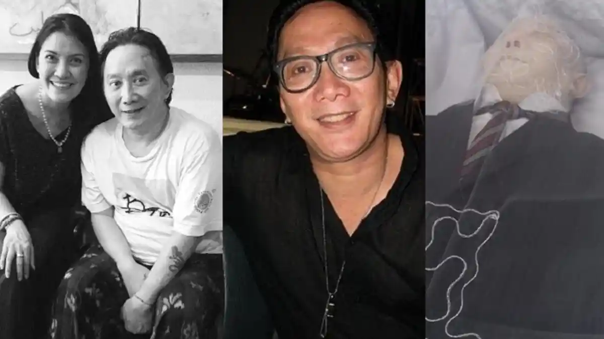 7 Hal Mudah Cegah Stroke, Penyakit yang Pernah Diderita Robby Tumewu yang Hari Ini Meninggal Dunia