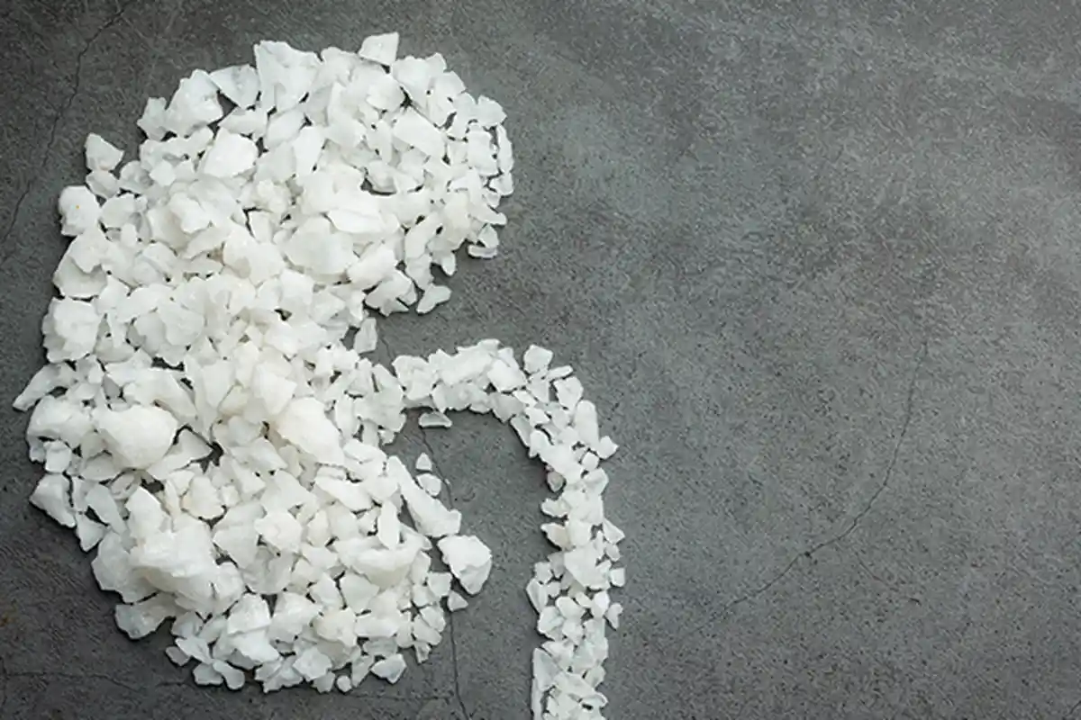 JAGA GINJAL dengan Bahan Alami Berikut Ini, Ada Bawang hingga Sayuran