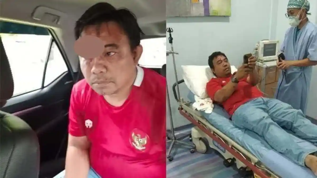 Ketua KNPI Dianiaya, Kabid Humas: Dikeroyok 3 Orang Pakai Batu 