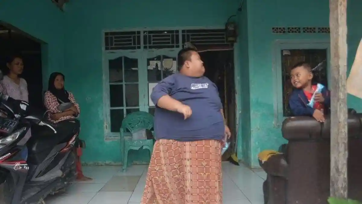 Bocah 11 Tahun dengan Berat Badan 115 Kg Meninggal Dunia saat Jalani Perawatan di RSUD Bekasi