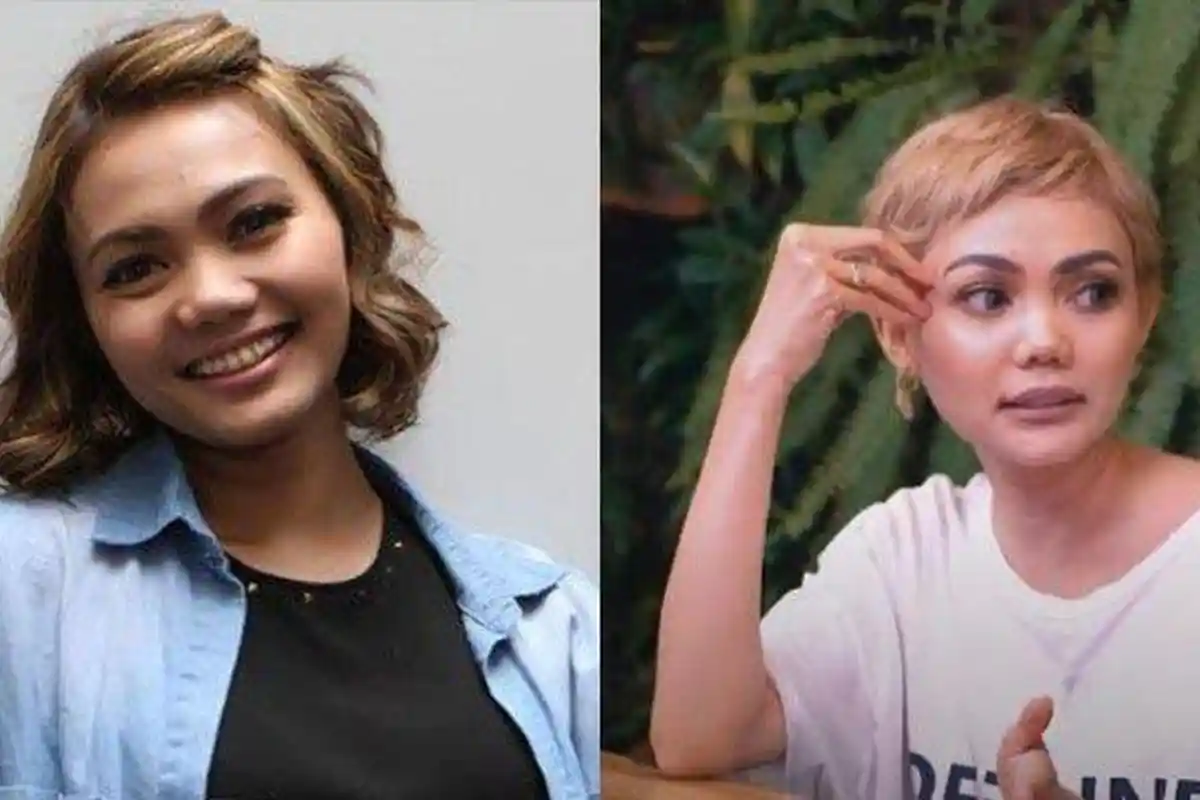 Penampilan Rina Nose Kini Berubah Drastis, Rambutnya Dipotong dan Dicat Sendiri