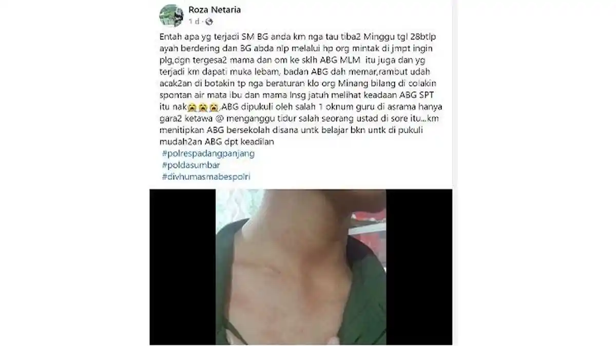 VIRAL Siswa di Padang Panjang Kena Pukul Oknum Guru hingga Memar, Keluarga Berharap Keadilan