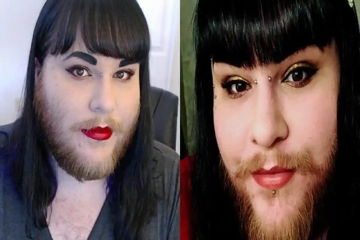 Wanita Berjanggut Ini Berubah Percaya Diri Setelah Menemukan Cintanya, Pacarnya Ternyata Tak. . .