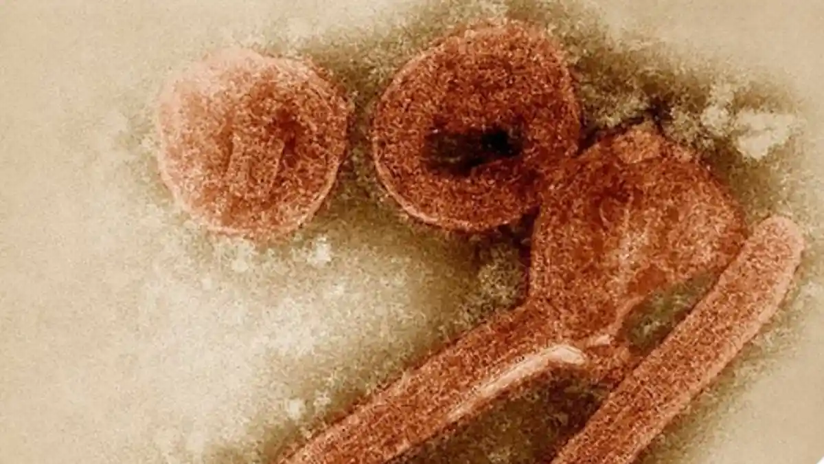 Kasus Virus Marburg Ditemukan di Afrika Barat, Sangat Menular dan Berpotensi Menyebar Jauh dan Luas